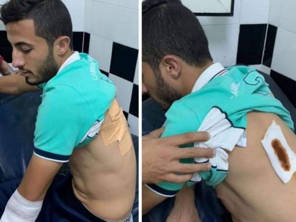 الحسوني لاعب الوداد المغربي يتعرض للطعن على يد مشجعين لفريق الرجاء البيضاوي