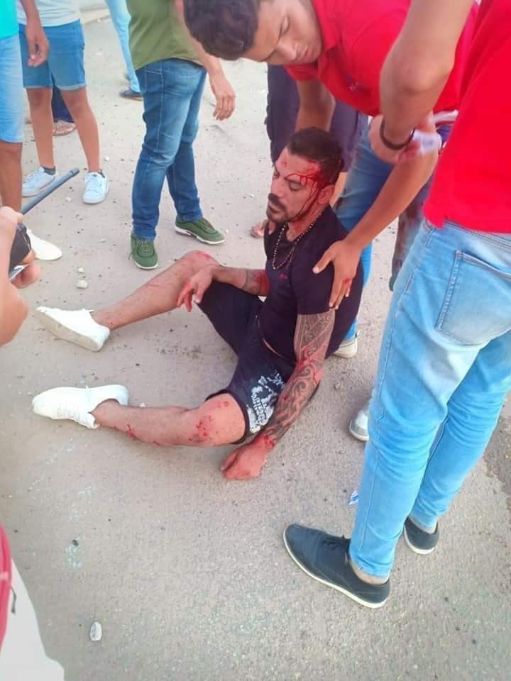 أخبار الدوري المصري : عاجل.. حجز عمرو زكي بالعناية المركزة بعد الحادث المروع